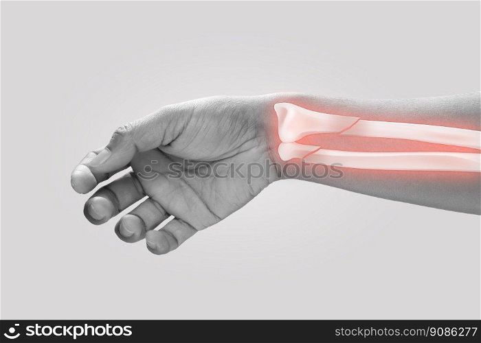 Men at higher risk of wrist fractures. Pain concept