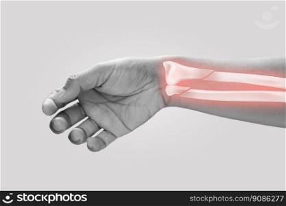 Men at higher risk of wrist fractures. Pain concept