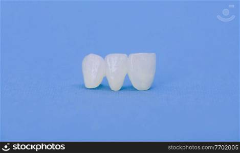 Metal free ceramic dental crowns isolated on a blue background