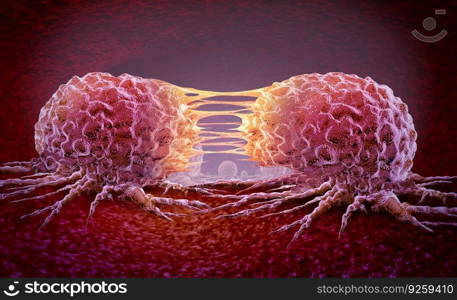 Metastasis Cancer cell and oncology or Malignant Cancerous Growth as growing dividing tumor cells and Malignancy disease spreading metastasized on an organ inside the human body as a 3D illustration.