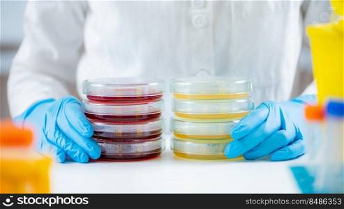 Microbiologist preparing bacterial cultures in a research laboratory, holding Petri dish stacks with bacteria cultures spread over nutritional and blood agar surfaces.  . Microbiologist preparing bacterial cultures in a research laboratory, holding Petri dish stacks with bacteria cultures spread over nutritional and blood agar surfaces. 
