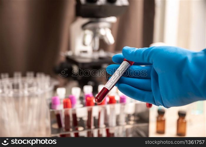 microbiologist with a tube of sample by Coronavirus with label Covid-19 / doctor in the laboratory for analysis and sampling of Covid-19 infectious disea