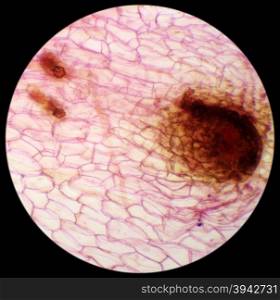 Micrograph of new sporophyte of fern leaf prothallium, background (Fern Prothallium W.M.)&#xA;