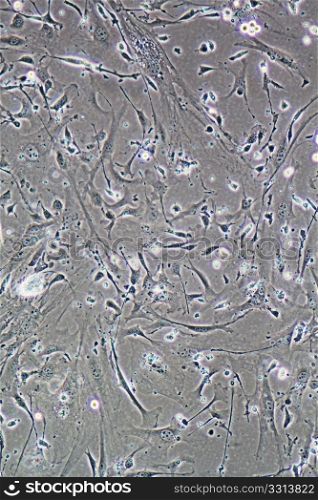 Microscope view of Muscle cells, fibroblasts and myoblasts, in tissue culture showing walls, nucleus and organelles.