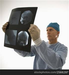 Mid-adult Caucasian male doctor looking at an x-ray.