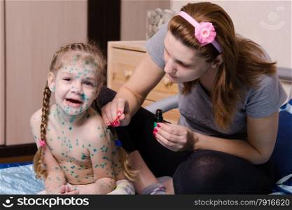 Mom misses zelenkoj sores on the body of a child suffering from chickenpox. Girl suffering from chicken pox yells when my mother misses sores zelenkoj