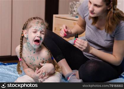 Mom misses zelenkoj sores on the body of a child suffering from chickenpox. Girl suffering from chicken pox crying when my mother misses sores zelenkoj