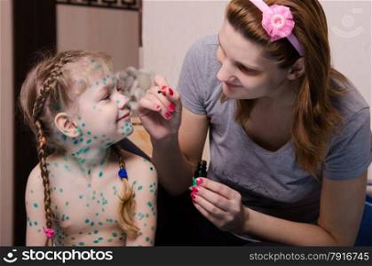 Mom misses zelenkoj sores on the face of a child suffering from chickenpox. Mama misses the child with chickenpox sores zelenkoj