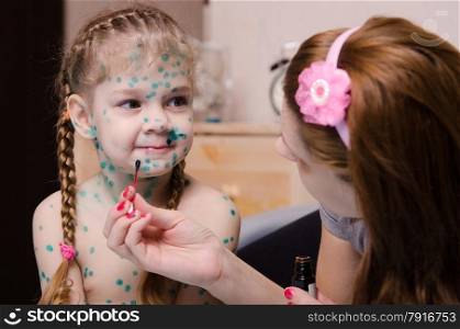 Mom misses zelenkoj sores on the face of a child suffering from chickenpox. Mom cauterize zelenkoj rash in a child with chickenpox
