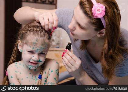 Mom misses zelenkoj sores on the face of a child suffering from chickenpox. Mom plaster zelenkoj child with chickenpox sores