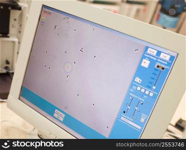 Monitor showing an intra cytoplasmic sperm injection (selective focus)