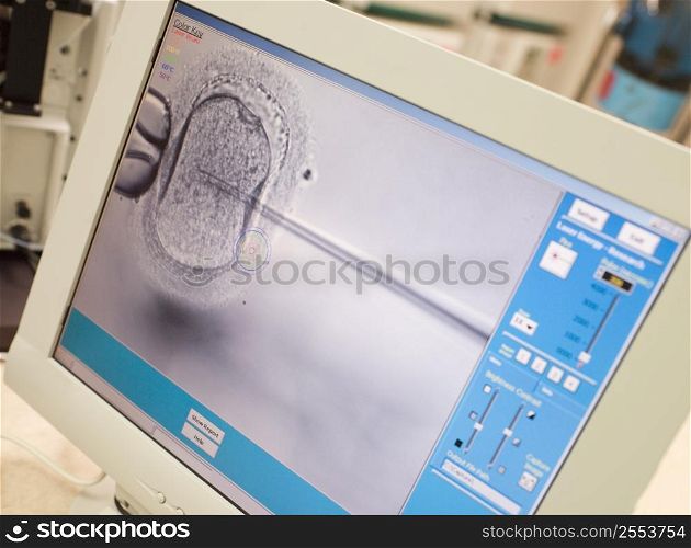 Monitor showing an intra cytoplasmic sperm injection (selective focus)