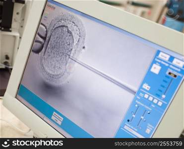 Monitor showing intra cytoplasmic sperm injection (selective focus)