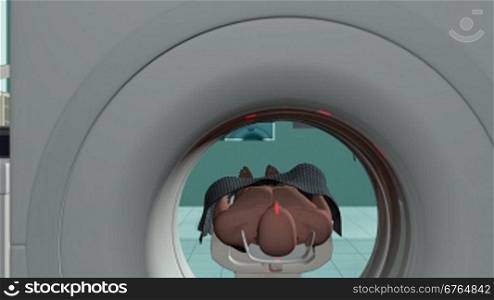 MRI Hospital, Camera Fly from Brain Scan, Alpha