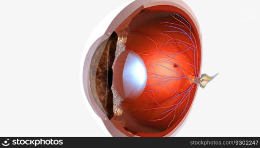 Myopia, is a common visual condition in which the eye s ability to focus on distant objects is impaired. 3D rendering. Myopia, is a common visual condition in which the eye s ability to focus on distant objects is impaired.