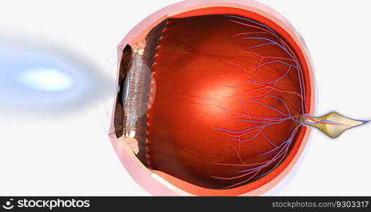 Myopia, is a common visual condition in which the eye s ability to focus on distant objects is impaired. 3D rendering. Myopia, is a common visual condition in which the eye s ability to focus on distant objects is impaired.