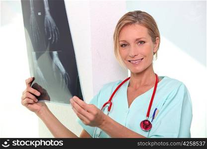 Nurse holding x-ray image of hand