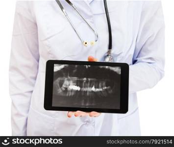 nurse holds tablet pc with X-ray picture of human jaws with dental crown screen isolated on white background