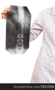 nurse shows X-ray picture with human vertebral column isolated on white background