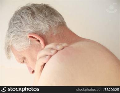 Older man with an itchy rash on his back