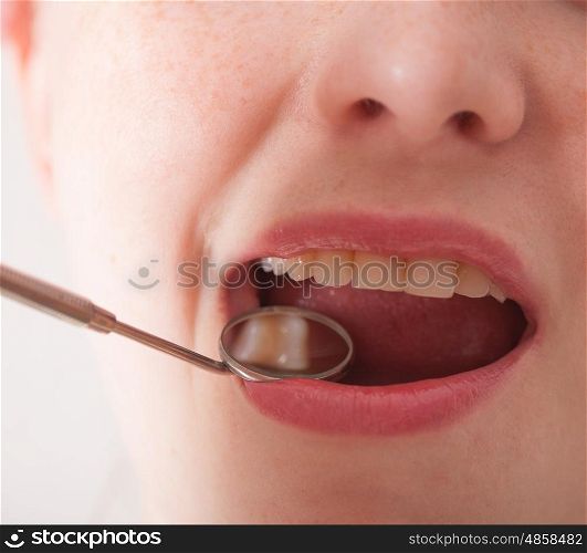 Open mouth of woman with dentist mirror during checking teeth. Check the teeth