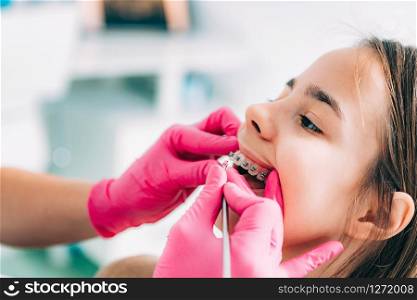 Orthodontist fixing girl&rsquo;s dental braces