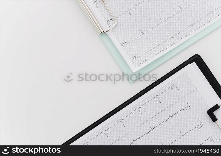 overhead view ecg medical report blue black clipboard white background. High resolution photo. overhead view ecg medical report blue black clipboard white background. High quality photo