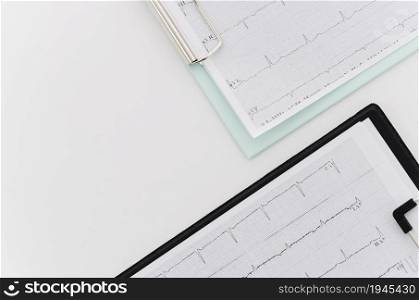 overhead view ecg medical report blue black clipboard white background. High resolution photo. overhead view ecg medical report blue black clipboard white background. High quality photo