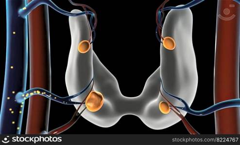 Overview of Parathyroid Disease- tumor growth 3d illustration. Overview of Parathyroid Disease- tumor growth