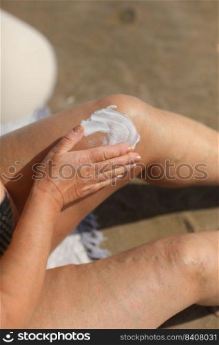 overweight woman applying sunscreen lotion on her legs with varicose veins, close up detail. vacation on sea beach. overweight woman applying sunscreen lotion on her legs with varicose veins, close up detail. vacation on sea beach.
