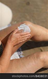 overweight woman applying sunscreen lotion on her legs with varicose veins, close up detail. vacation on sea beach. overweight woman applying sunscreen lotion on her legs with varicose veins, close up detail. vacation on sea beach.