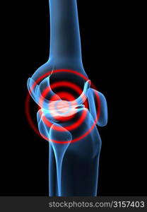 painful knee joint