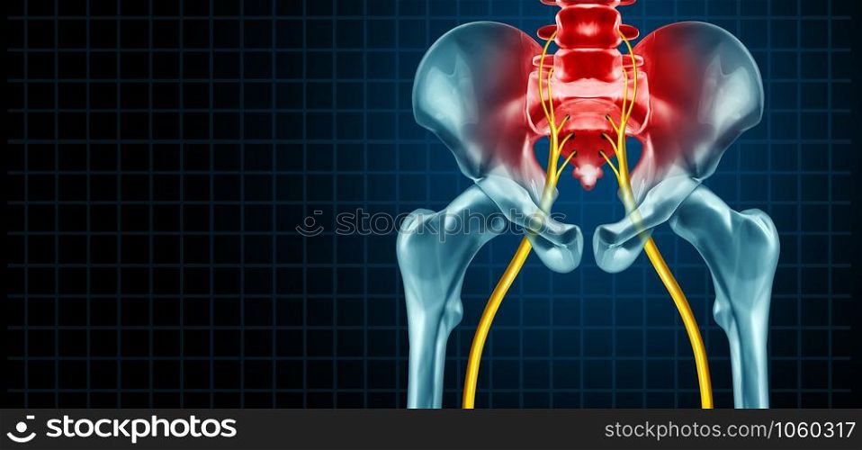 Painful sciatica nerve symptom and pain diagnosis as a medical concept for a disease causing physical problems with 3D illustration elements.