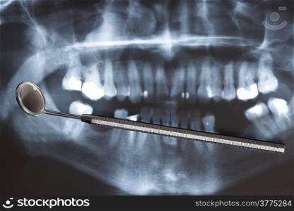 Panoramic x-ray image scan of humans teeth and dental mirror