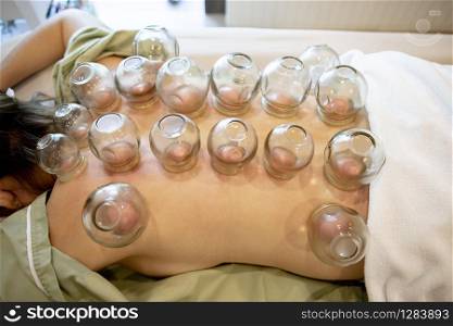 patience undergoing of chinese cupping therapy