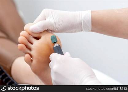 Peeling feet pedicure procedure from callus on foot by hands of podiatrist in white gloves at beauty salon. Peeling feet pedicure procedure on foot