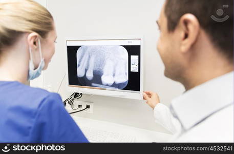 people, medicine, stomatology and health care concept - close up of dentist and assistant looking at x-ray on monitor screen at dental clinic