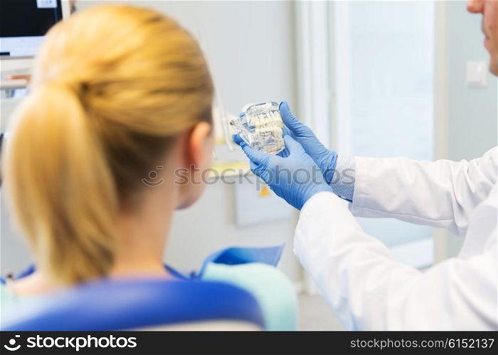 people, medicine, stomatology and health care concept - happy male dentist showing jaw and teeth layout to patient woman at dental clinic office