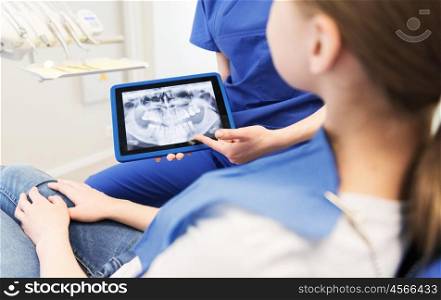 people, medicine, stomatology, technology and health care concept - close up of female dentist showing teeth x-ray on tablet pc computer screen to patient girl at dental clinic office