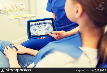 people, medicine, stomatology, technology and health care concept - close up of female dentist showing teeth x-ray on tablet pc computer screen to patient girl at dental clinic office