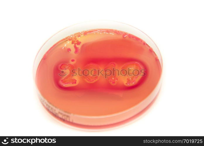 Petri dish, germ concept, year 2019