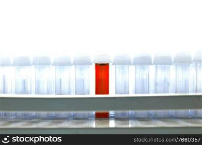 Photo of blood on test tube in laboratory