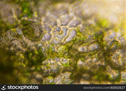 Pickled cucumber under the microscope.