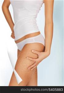 picture of woman in cotton underwear showing good skin concept