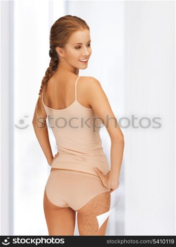 picture of woman with magnifier sheet showing cellulite