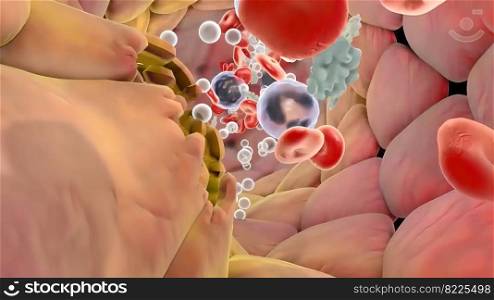Plaque formation in the cardiovascular tract 3D illustration. Plaque formation in the cardiovascular tract