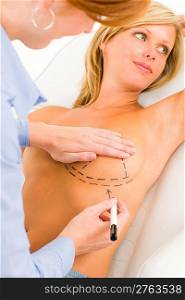 Plastic surgery female doctor draw line patient breast augmentation implant