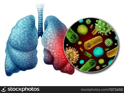Pneumonia infection anatomy as a medical concept as inflammation in the human lungs infected by virus and bacteria as a lung disease diagnosis with 3D illustration elements.