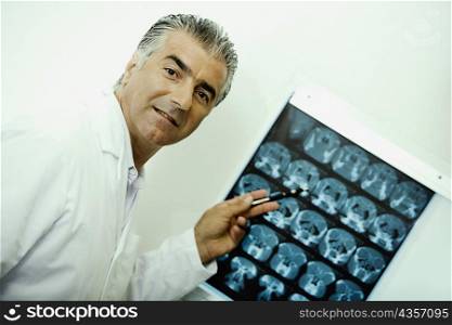 Portrait of a male doctor pointing at an X-Ray