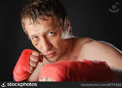 Portrait of a man with a black eye in a battle position. Clenched fists. Dark background.